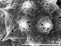 acetolyzed pollen,exine surface