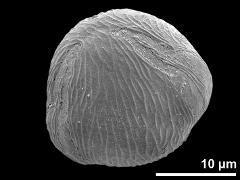 equatorial view (oblique)