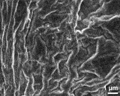 exine surface of hydrated tetrad