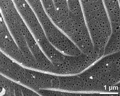 exine surface