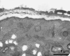 pollen wall at transition of aperture and interapertural area