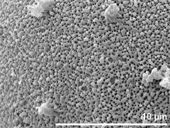 exine surface