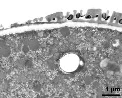 pollen wall at transition of aperture and interapertural area