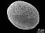 distal polar view
