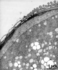 pollen wall stratification next to aperture (left)