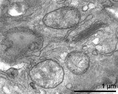 mitochondria and dictyosom in vegetative cytoplasm