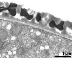 pollen wall, interapertural area