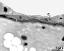 apertural area of pollen wall, intine (I), endexine (E)