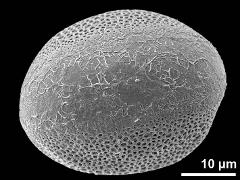 distal polar view