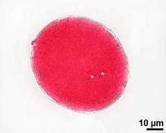 pollen grain with sperm cells (asterisks)