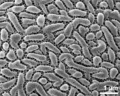exine surface