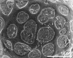 exine surface