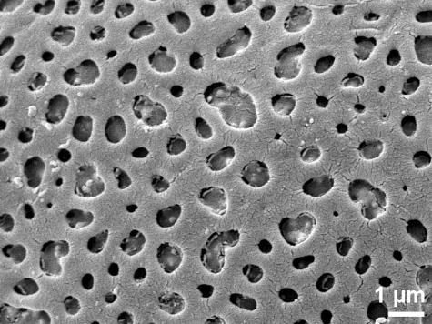 exine surface