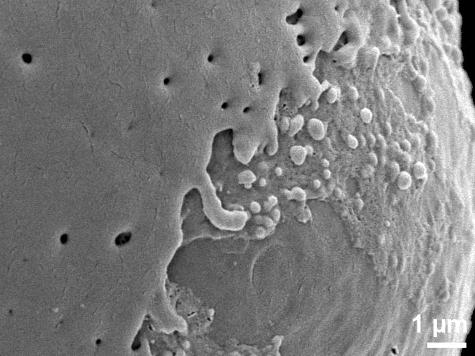 aperture detail