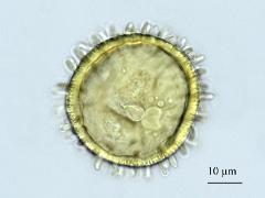 acetolyzed pollen,equatorial view