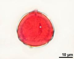 pollen grain with generative cell (asterisk)