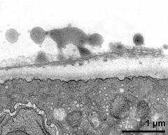 pollen wall at transition of aperture and interapertural area