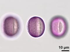 hydrated pollen,equatorial view