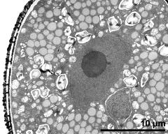  generative cell (right) and organells