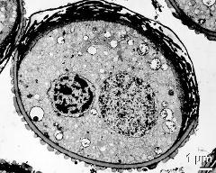 bi-cellular pollen grain with large sulcus