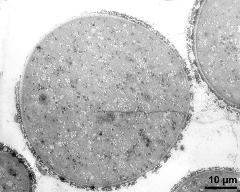 pollen grain in cross section