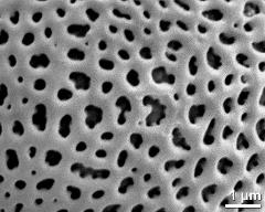 detail of exine surface