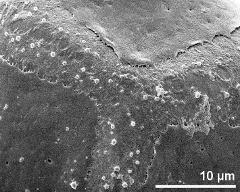 anostomosing colpi