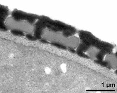 interapertural area of pollen wall