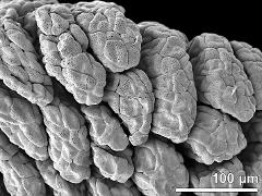 massulae (forming pollinium)