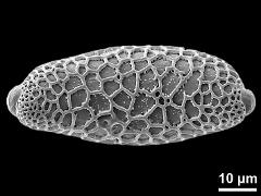 polar proximal view