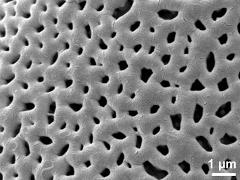 exine surface