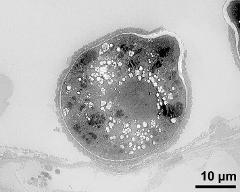 pollen grain in cross section