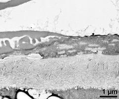 pollen wall at transition of aperture and interapertural region