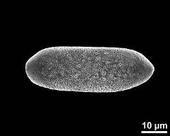 dry pollen grain in polar view (proximal)