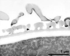 interapertural area of pollen wall