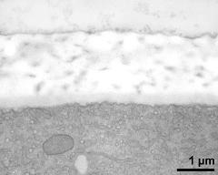 apertural area of pollen wall