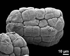 hydrated tetrads (forming massula)