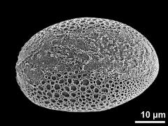 polar distal view