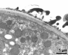 pollen wall at transition of aperture and interapertural region