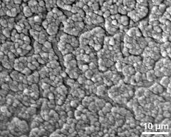 acetolysed pollen, crushed, detail of endexine