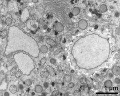 vegetative nucleus (left) and generative cell