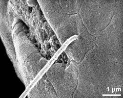 insertion of viscin threads