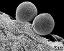 pollen grains with Ubisch bodies