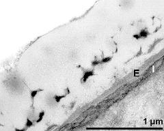 interapertural area of pollen wall, intine (I) , endexine (E)