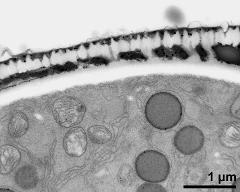 pollen wall, interapertural area