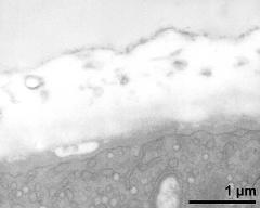 apertural area of pollen wall