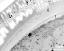 interapertural area of pollen wall, intine (I), endexine (E)
