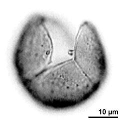 upper polar focus of pollen grain