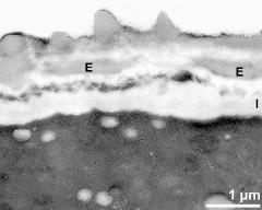 apertural area of pollen wall, intine (I), endexine (E)