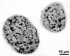 pollen grains in cross section